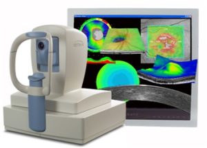 Ocular Coherence Tomography Test