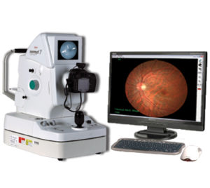 Fundus